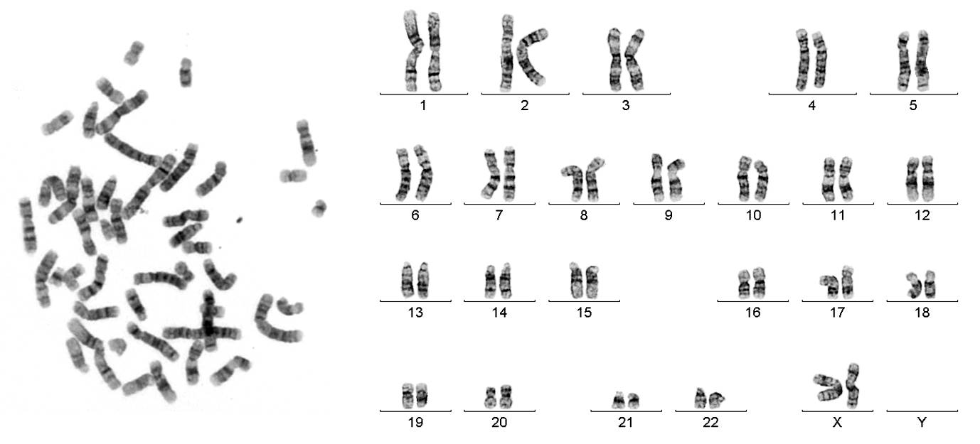 Metafase y Cariotipo